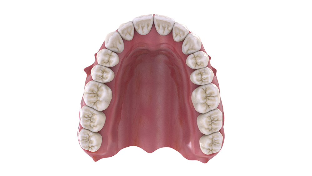 MeshAlign | Development of systems for dental aligners companies and ...