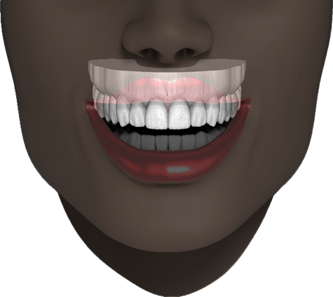 Our specialists can develop an aesthetic mockup of the patient’s teeth