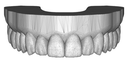 Aesthetic mockup of teeth