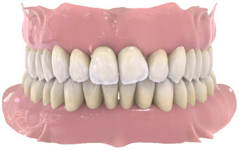 Violation tooth angulation